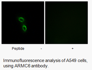 Product image for ARMC6 Antibody