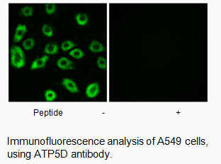 Product image for ATP5D Antibody