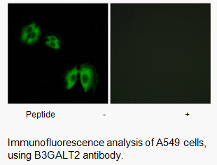 Product image for B3GALT2 Antibody