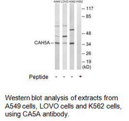 Product image for CA5A Antibody