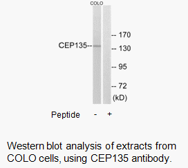 Product image for CEP135 Antibody