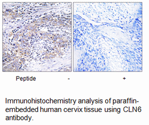 Product image for CLN6 Antibody