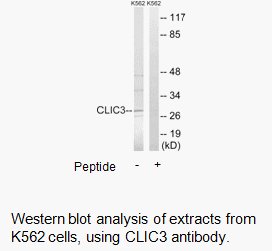 Product image for CLIC3 Antibody