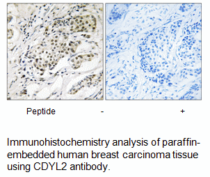 Product image for CDYL2 Antibody