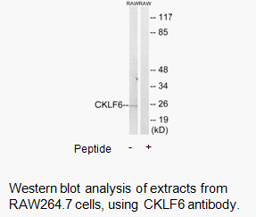 Product image for CKLF6 Antibody