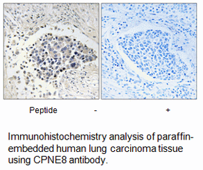 Product image for CPNE8 Antibody