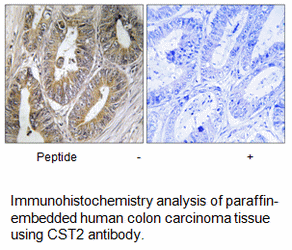 Product image for CST2 Antibody