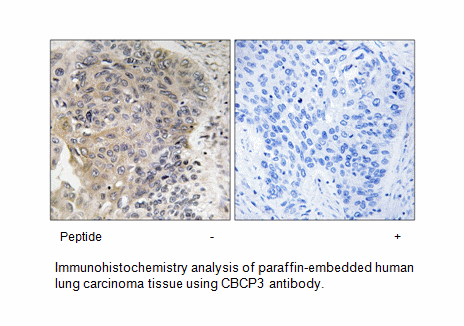 Product image for CBCP3 Antibody