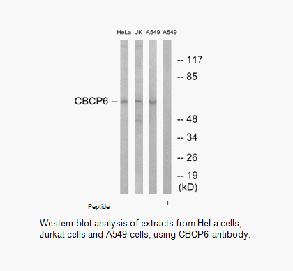 Product image for CBCP6 Antibody