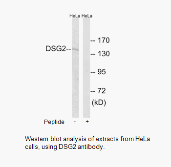 Product image for DSG2 Antibody