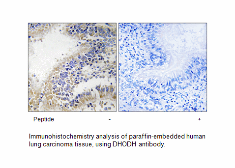 Product image for DHODH Antibody