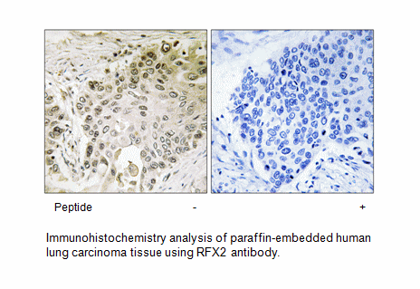 Product image for RFX2 Antibody