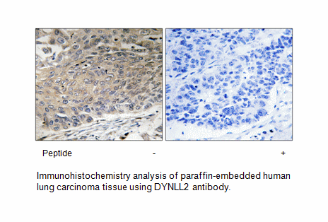 Product image for DYNLL2 Antibody