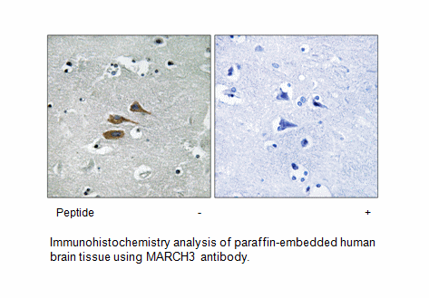 Product image for MARCH3 Antibody