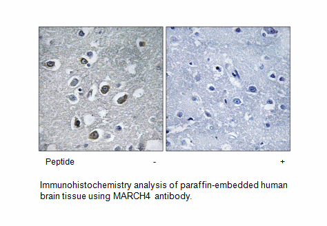 Product image for MARCH4 Antibody