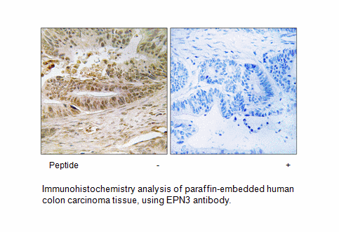 Product image for EPN3 Antibody