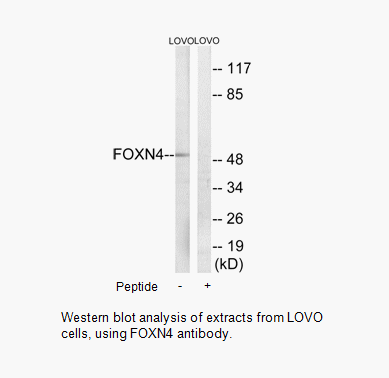 Product image for FOXN4 Antibody