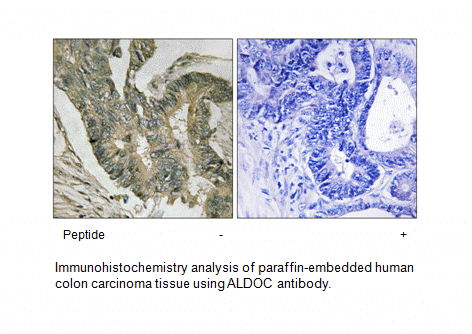 Product image for ALDOC Antibody