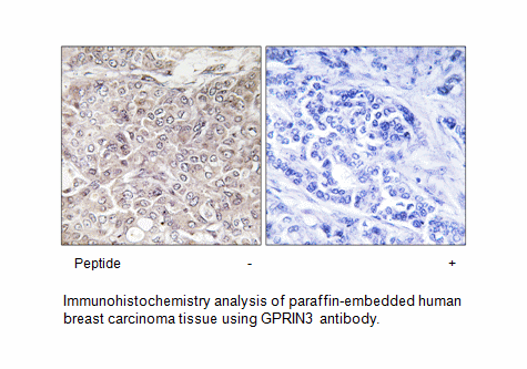 Product image for GPRIN3 Antibody