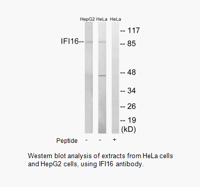 Product image for IFI16 Antibody