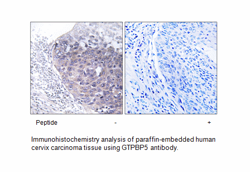 Product image for GTPBP5 Antibody