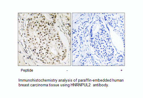 Product image for HNRNPUL2 Antibody