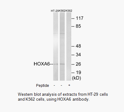 Product image for HOXA6 Antibody