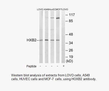 Product image for HOXB2 Antibody