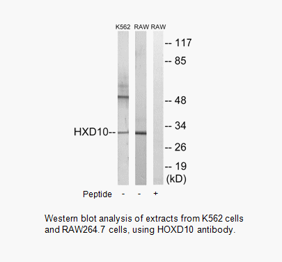 Product image for HOXD10 Antibody