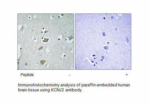 Product image for KCNJ2 Antibody