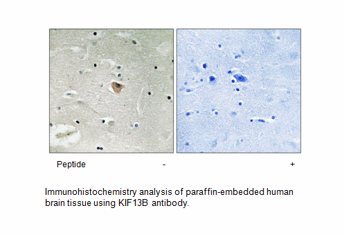 Product image for KIF13B Antibody