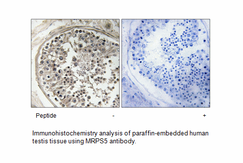 Product image for MRPS5 Antibody