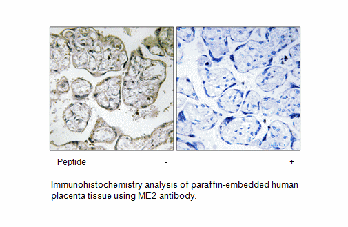 Product image for ME2 Antibody