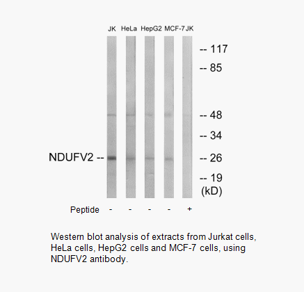 Product image for NDUFV2 Antibody