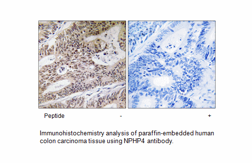 Product image for NPHP4 Antibody