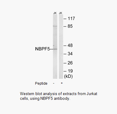 Product image for NBPF5 Antibody