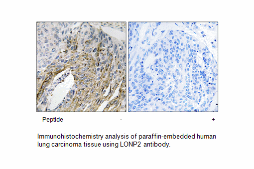 Product image for LONP2 Antibody