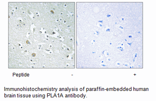 Product image for PLA1A Antibody