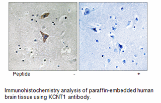 Product image for KCNT1 Antibody