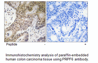 Product image for PRPF6 Antibody