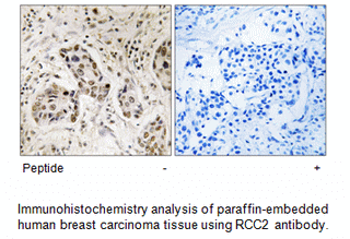 Product image for RCC2 Antibody