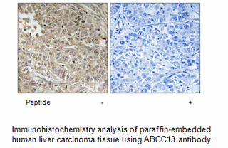 Product image for ABCC13 Antibody