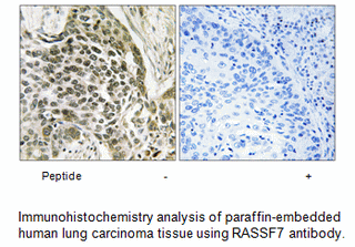 Product image for RASSF7 Antibody