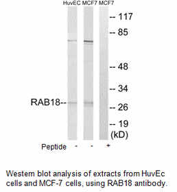 Product image for RAB18 Antibody