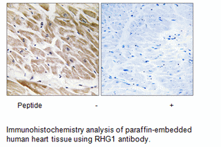 Product image for RHG1 Antibody