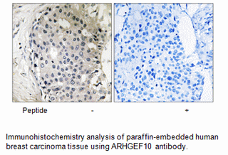 Product image for ARHGEF10 Antibody