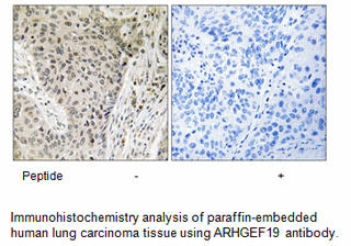 Product image for ARHGEF19 Antibody