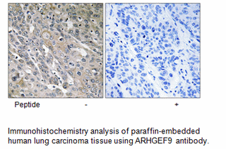 Product image for ARHGEF9 Antibody