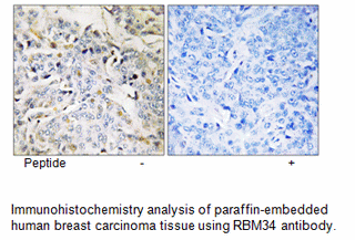 Product image for RBM34 Antibody