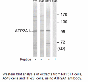 Product image for ATP2A1 Antibody